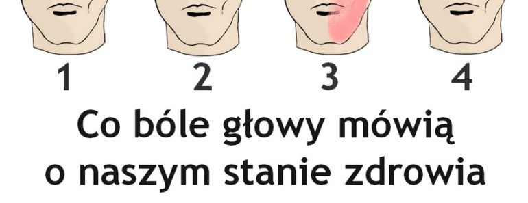 przepisynazdrowie.pl-jak-rozpoznac-bol-glowy-przyczyny-objawy-sposoby-na-bole-glowy