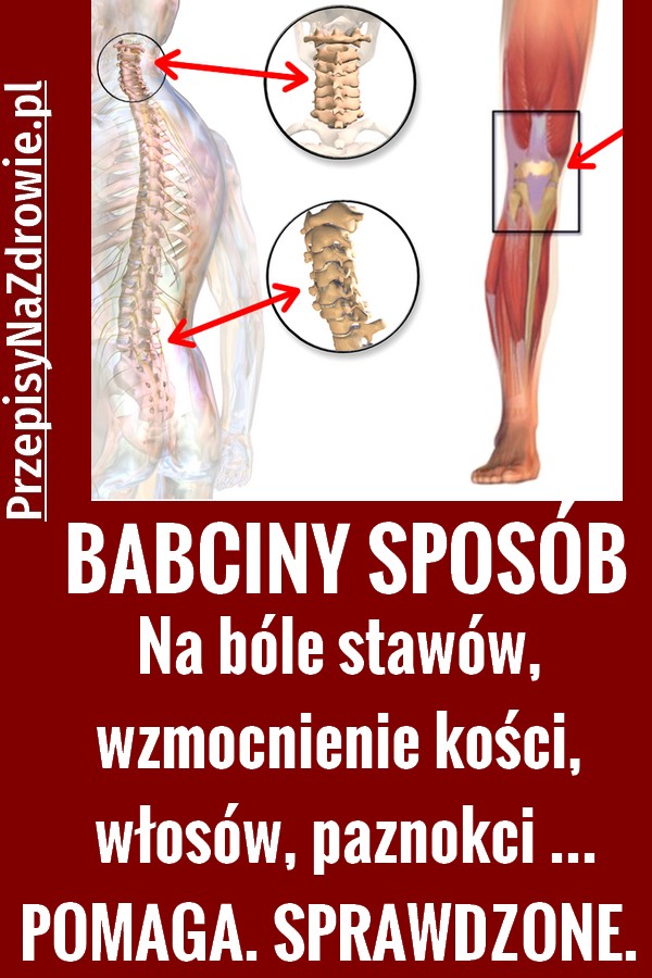 PRZEPISYNAZDROWIE..pl-NA-BOLE-STAWOW-BABCINY-PRZEPIS