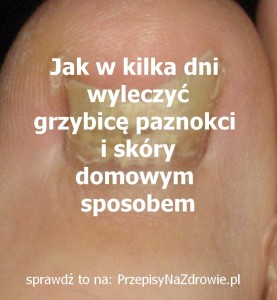 PrzepisyNaZdrowie.pl-jak-w-kilka-dni-wyleczyc-grzybice-paznokci-stop-skory